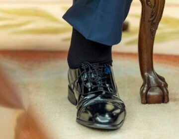 The left foot and swollen ankle of President Donald Trump